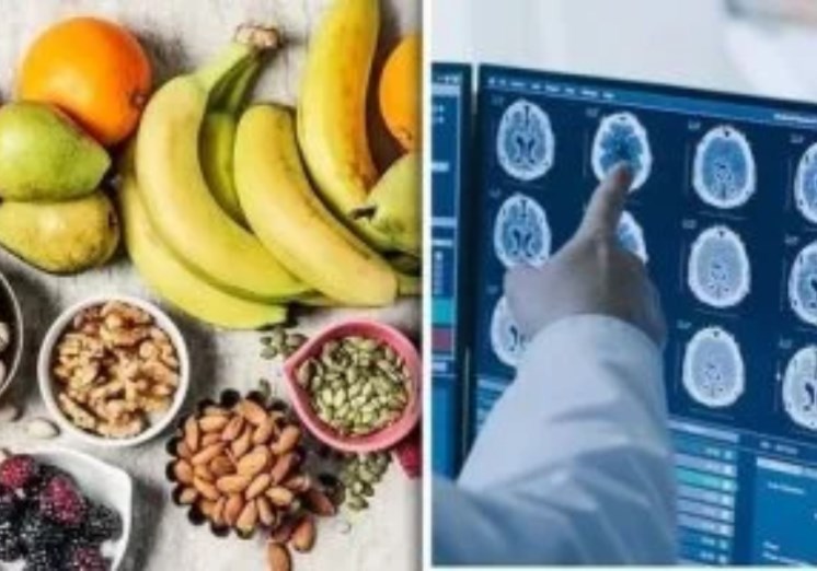 أطعمة تساعد فى الوقاية من الخرف