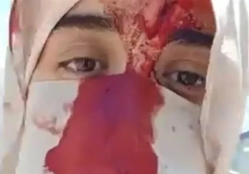 خناقة شوارع داخل عيادة أسنان بشبرا الخيمة